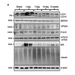 Merck Anti-VPS34 antibody produced in rabbit