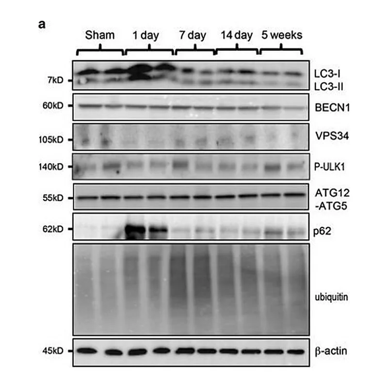 Merck Anti-VPS34 antibody produced in rabbit