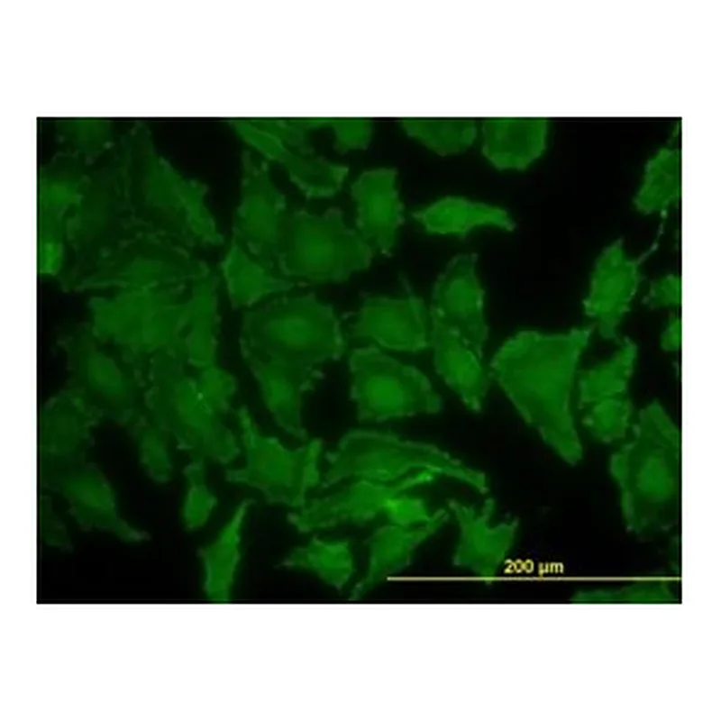 Merck MONOCLONAL ANTI-KRAS, ANTIBODY PRODUCED&