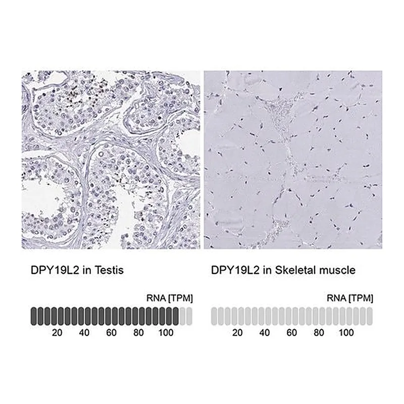 Merck Anti-DPY19L2 antibody produced in rabbit