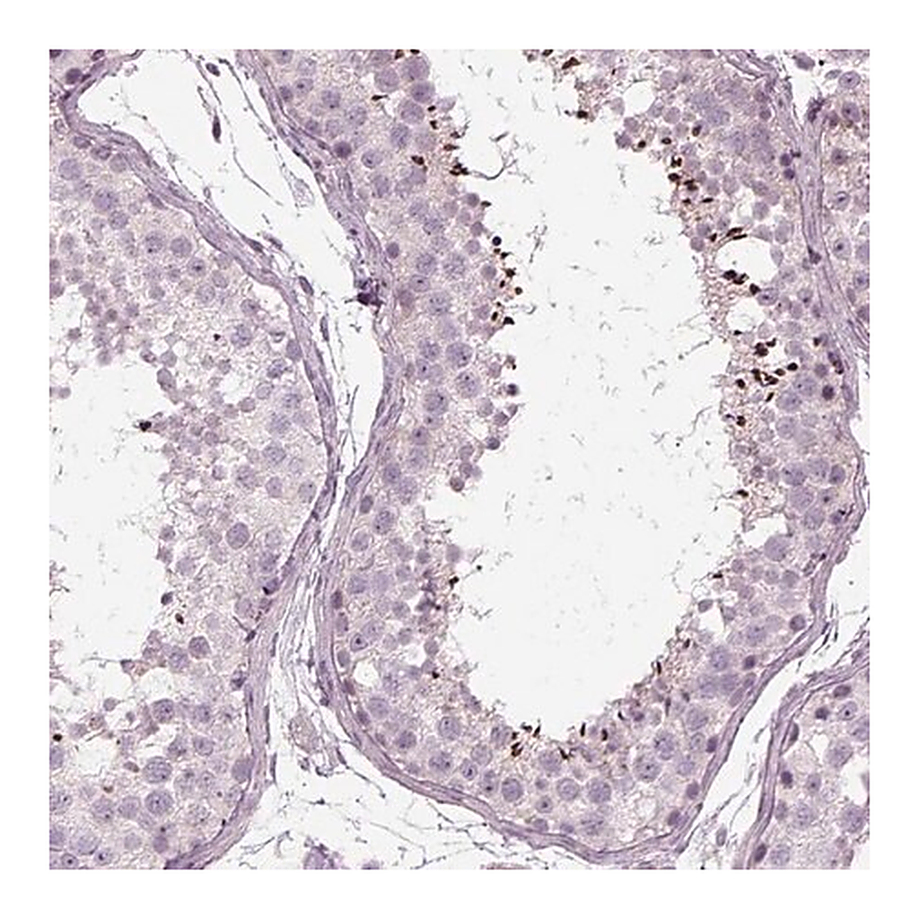Merck Anti-LRRIQ3 antibody produced in rabbit