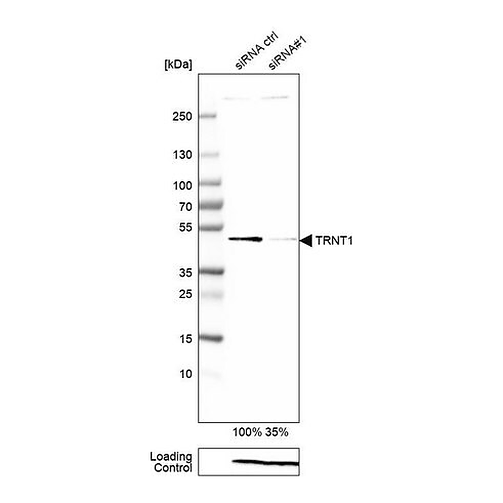 Merck Anti-TRNT1 antibody produced in rabbit