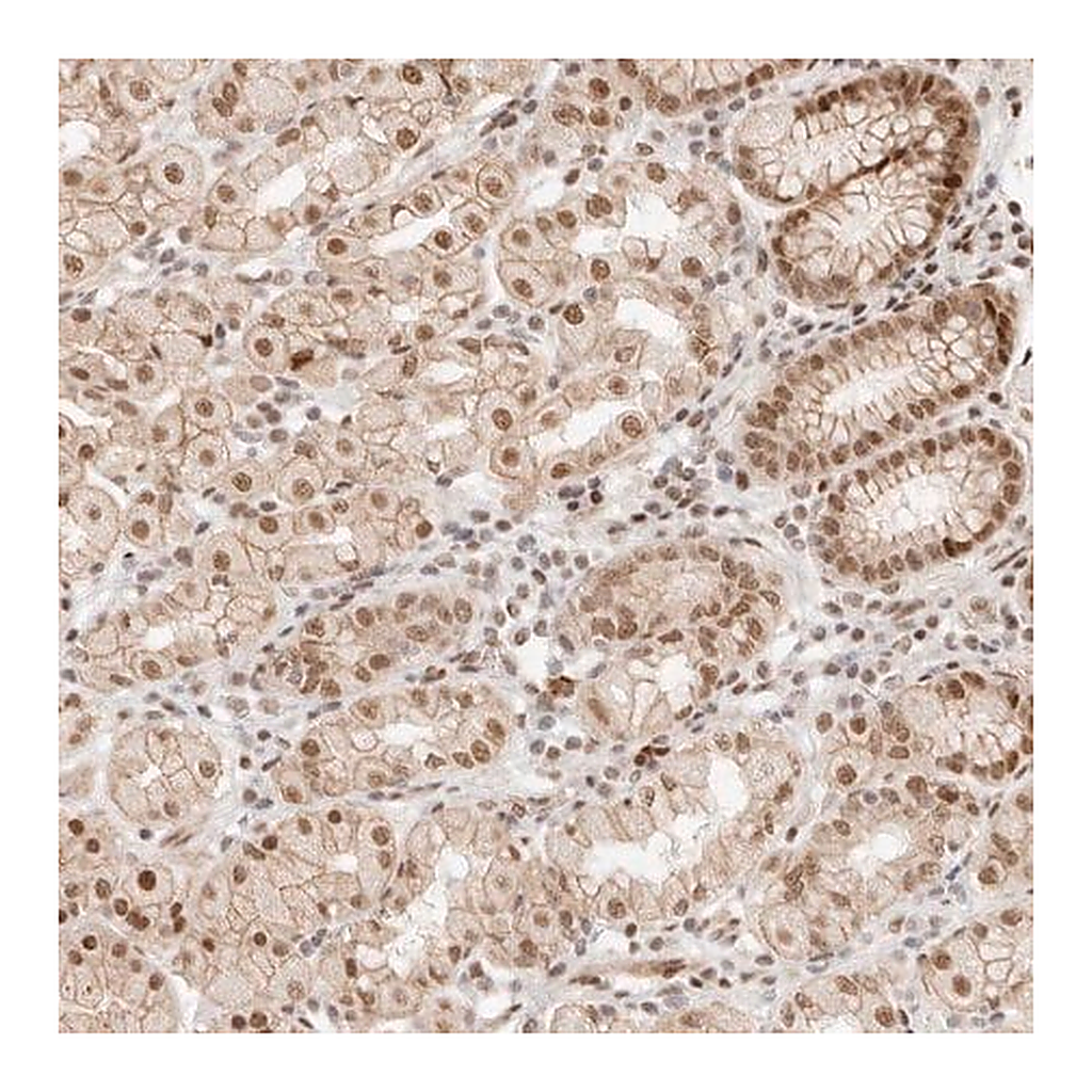 Merck Anti-HOXC5 antibody produced in rabbit