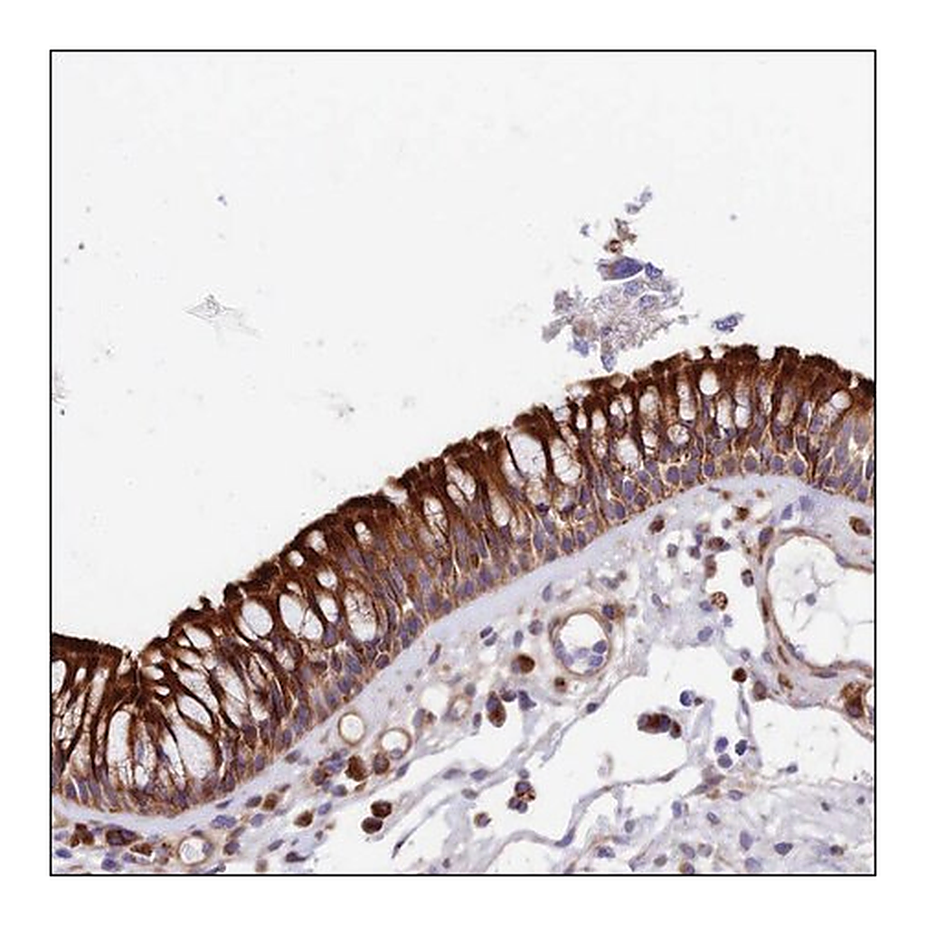 Merck Anti-VPS13C antibody produced in rabbit