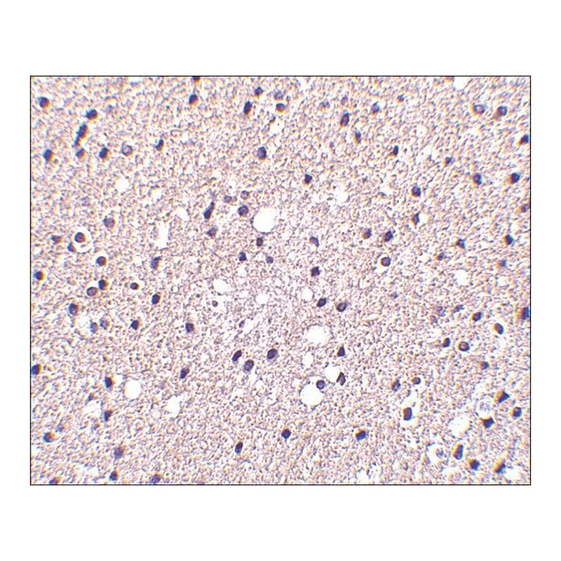 Merck Anti-Presenilin1 antibody produced in rabbit
