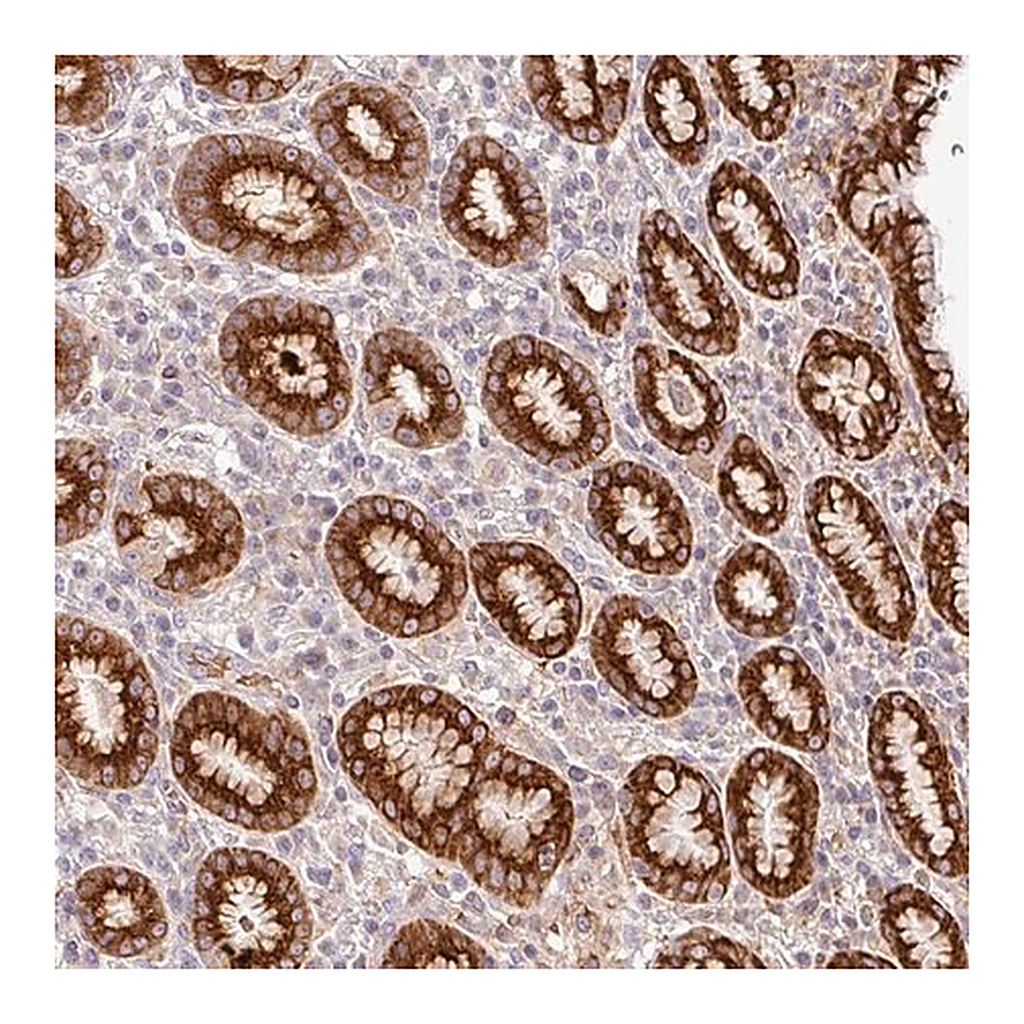 Merck Anti-RETNLB antibody produced in rabbit