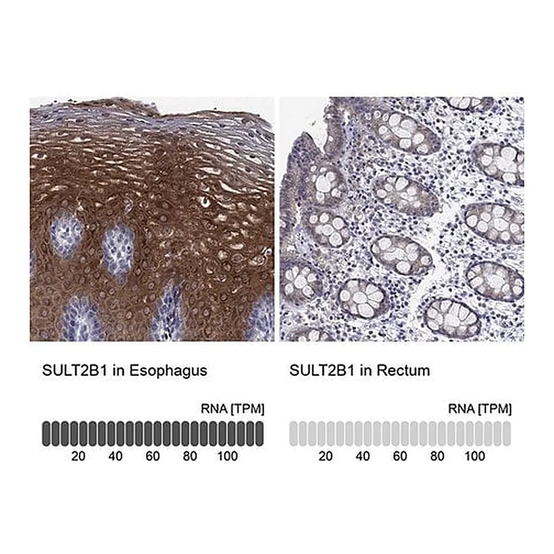 Merck Anti-SULT2B1 antibody produced in rabbit
