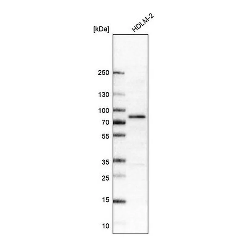 Merck Monoclonal Anti-RIPK1 antibody produced in mouse