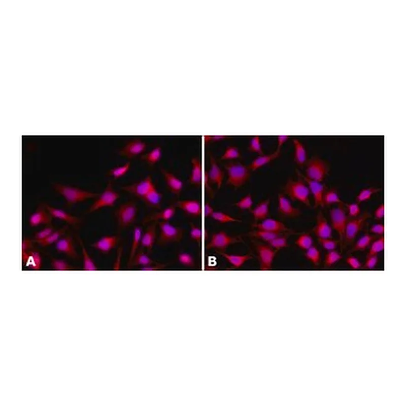Merck ANTI-HISTONE DEACETYLASE (HDAC4) (ML-19)