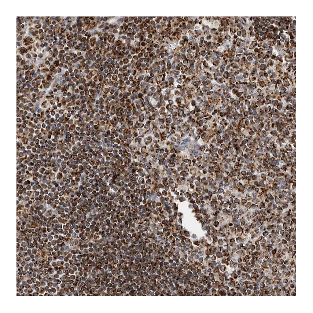 Atlas Antibodies Anti-RBM34 Antibody
