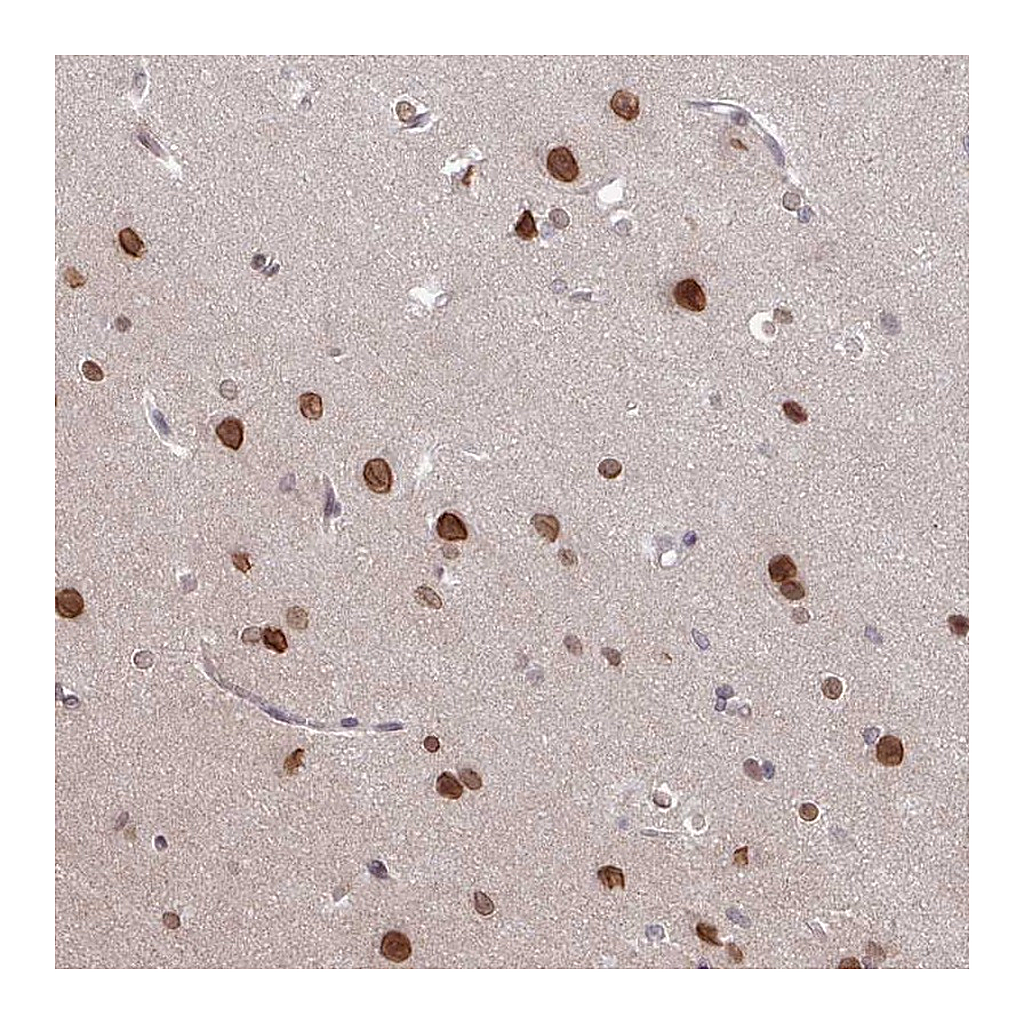 Atlas Antibodies Anti-RBM4 Antibody
