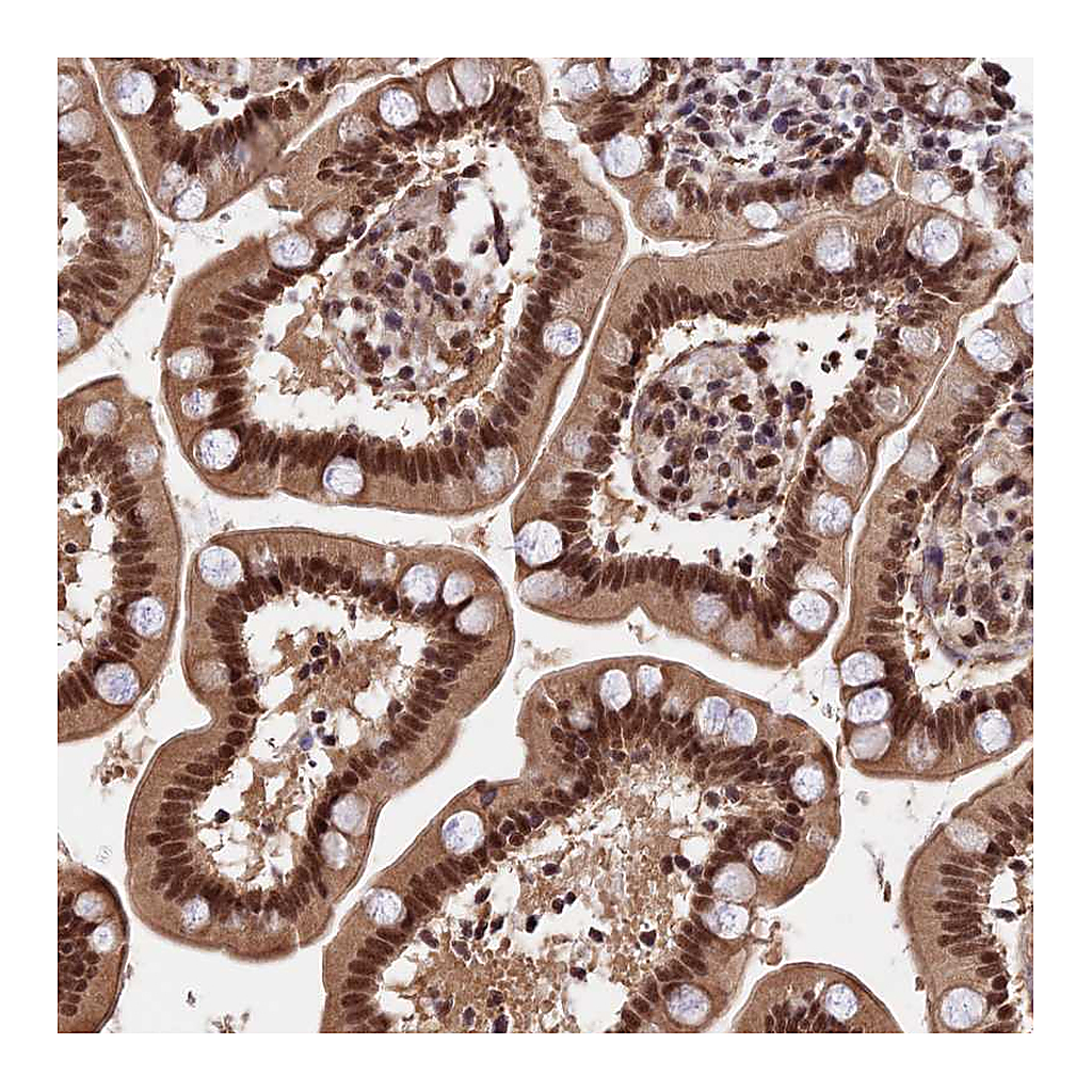 Atlas Antibodies Anti-RBM42 Antibody
