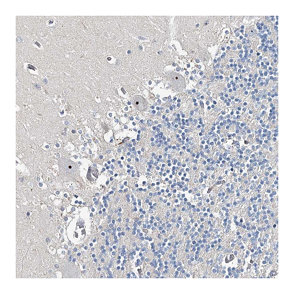 Atlas Antibodies Anti-RBM43 Antibody