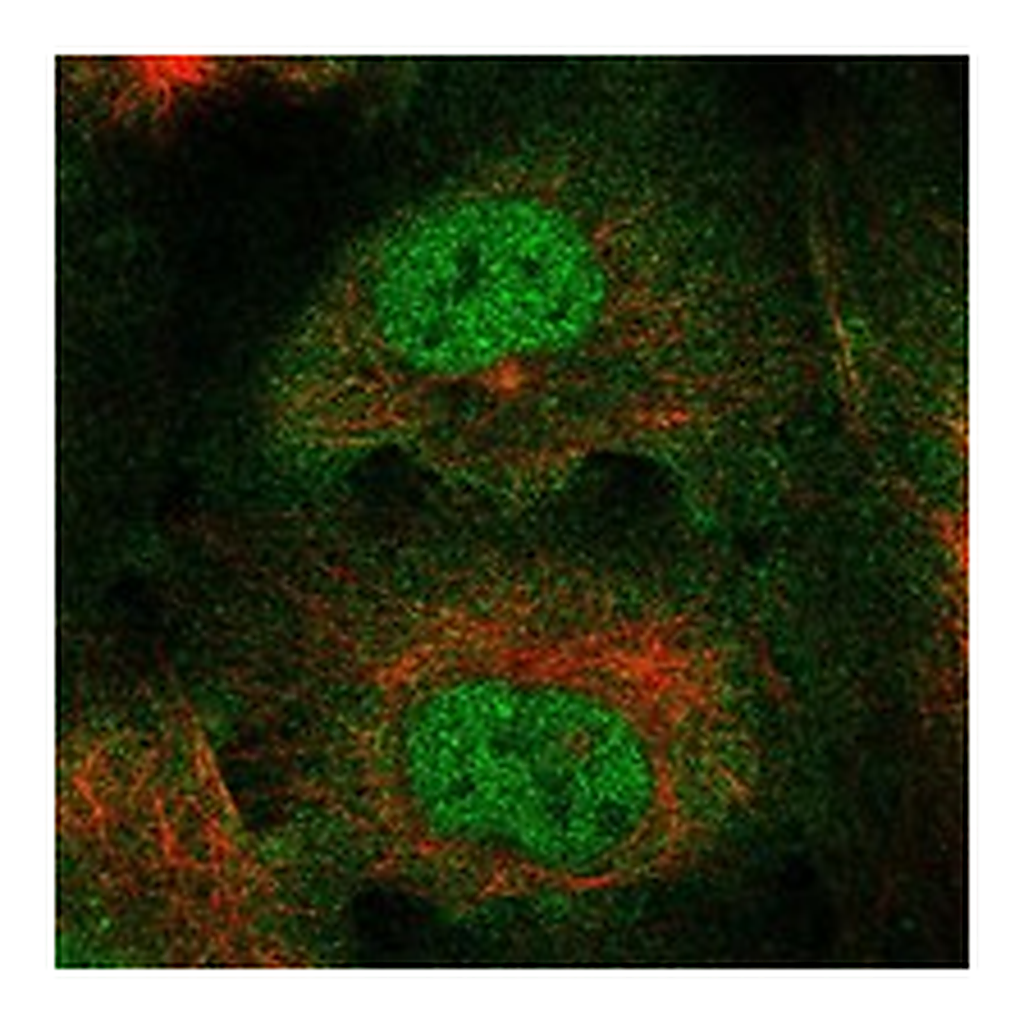 Atlas Antibodies Anti-RBM46 Antibody