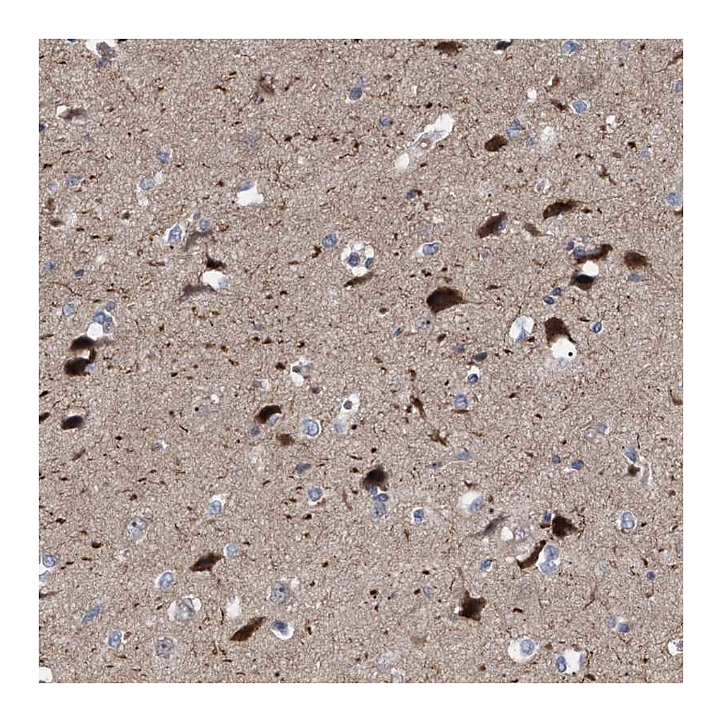 Atlas Antibodies Anti-RBM48 Antibody