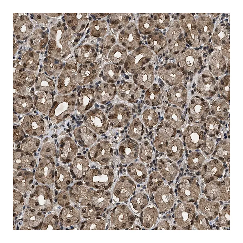 Atlas Antibodies Anti-RBM5 Antibody