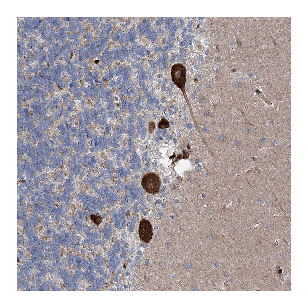 Atlas Antibodies Anti-RBMS3 Antibody