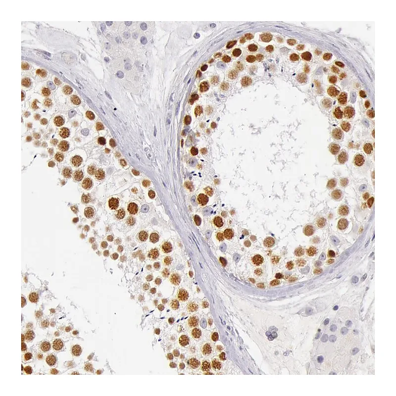 Atlas Antibodies Anti-RBMY1A1 Antibody