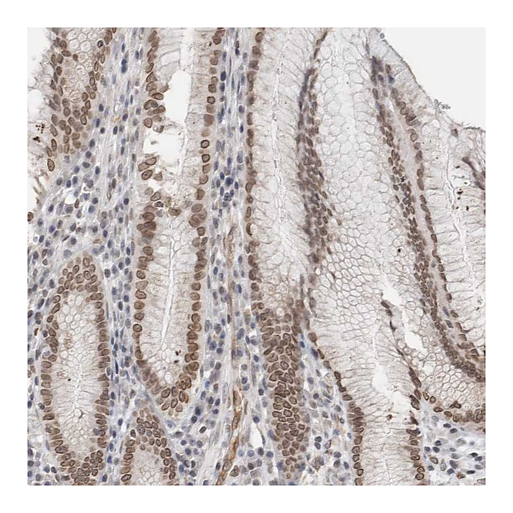 Atlas Antibodies Anti-RBMX2 Antibody
