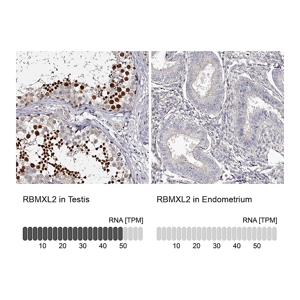 Atlas Antibodies Anti-RBMXL2 Antibody