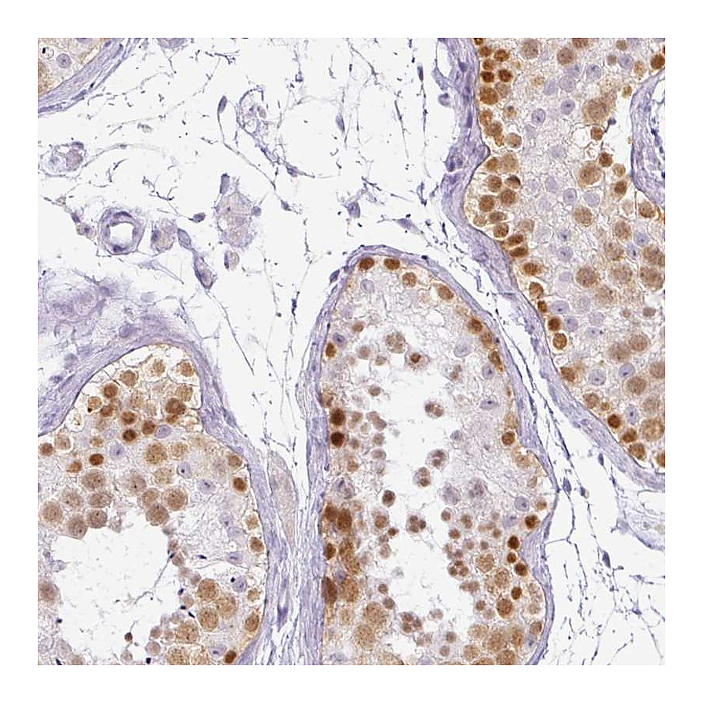 Atlas Antibodies Anti-RBMY1F Antibody