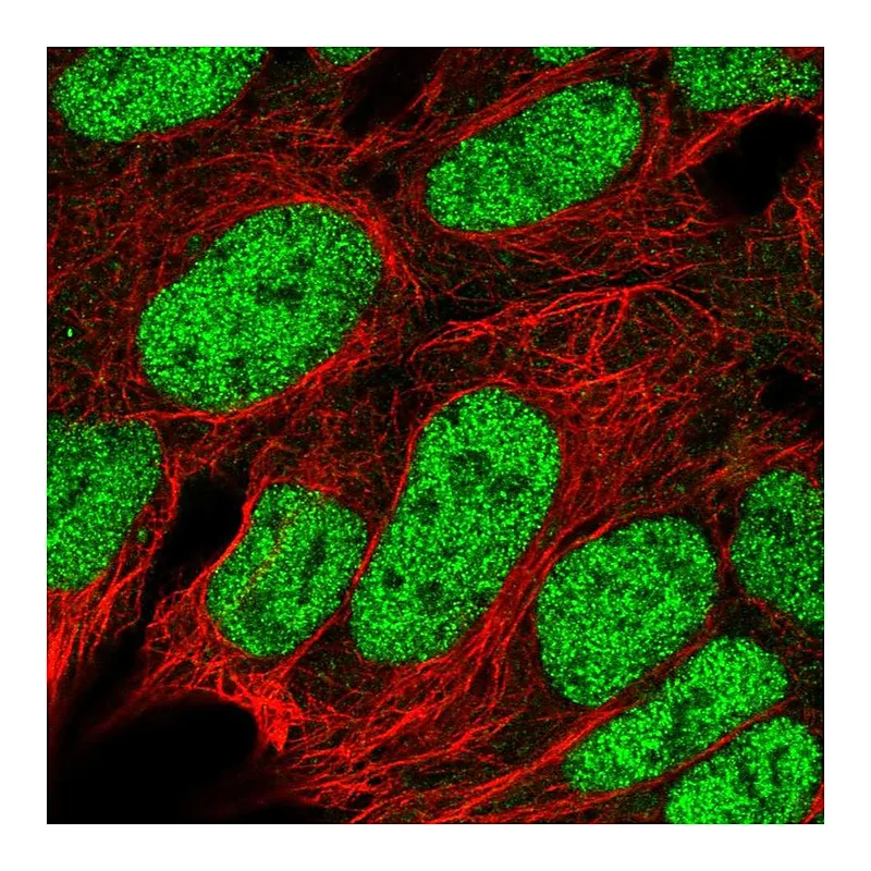Atlas Antibodies Anti-RBX1 Antibody