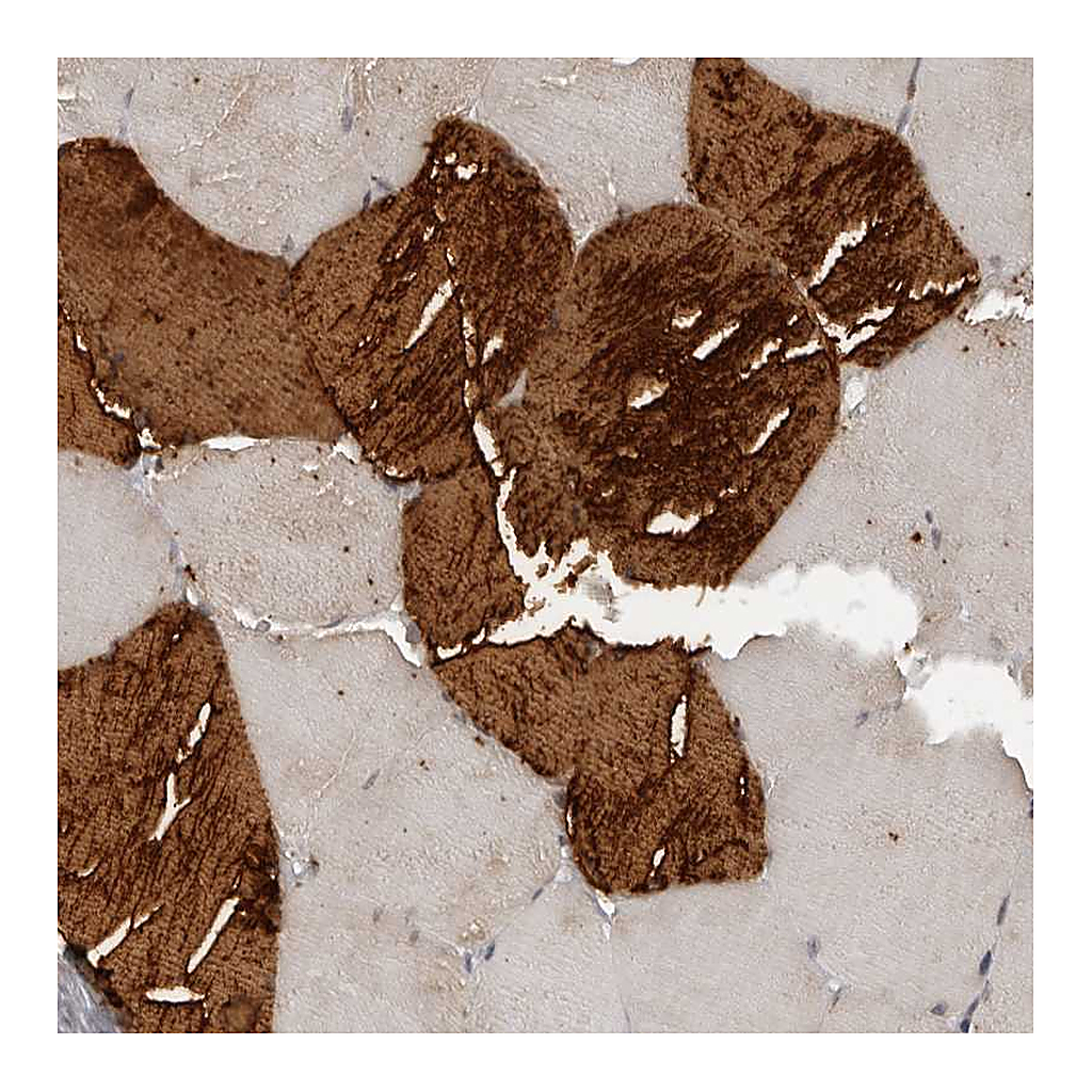Atlas Antibodies Anti-RC3H1 Antibody