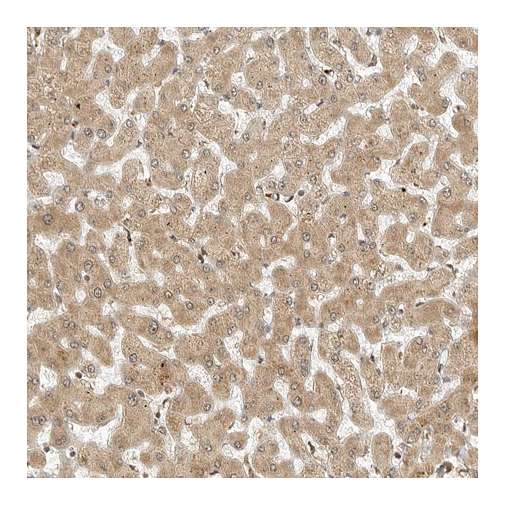 Atlas Antibodies Anti-RC3H1 Antibody