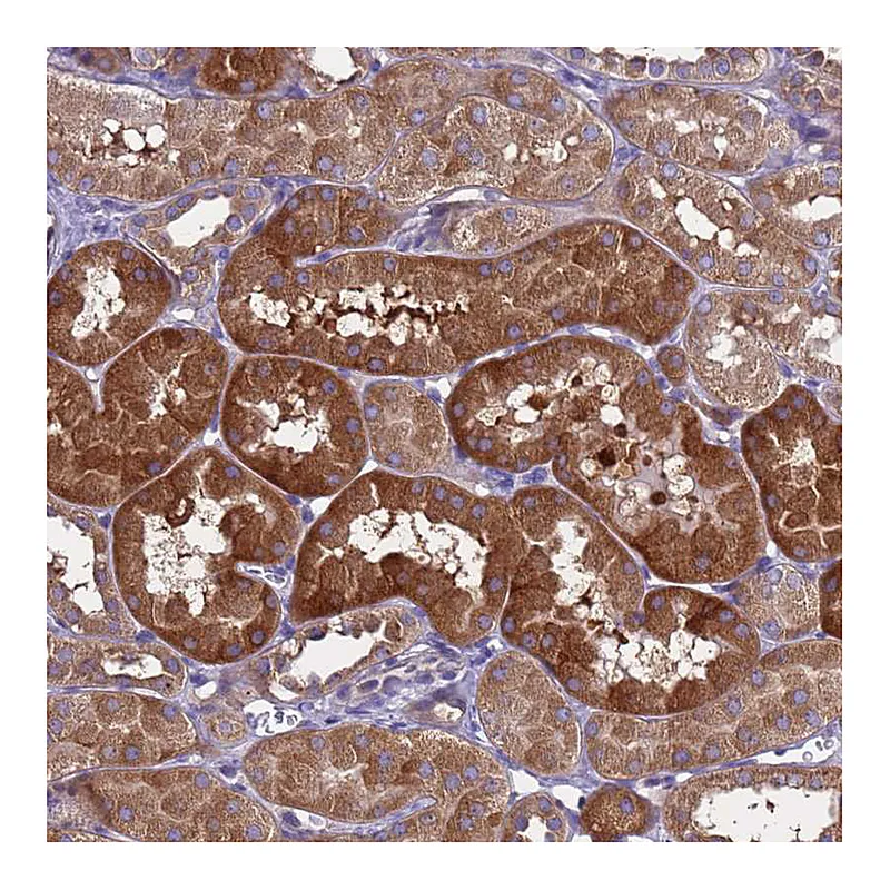 Atlas Antibodies Anti-RC3H2 Antibody