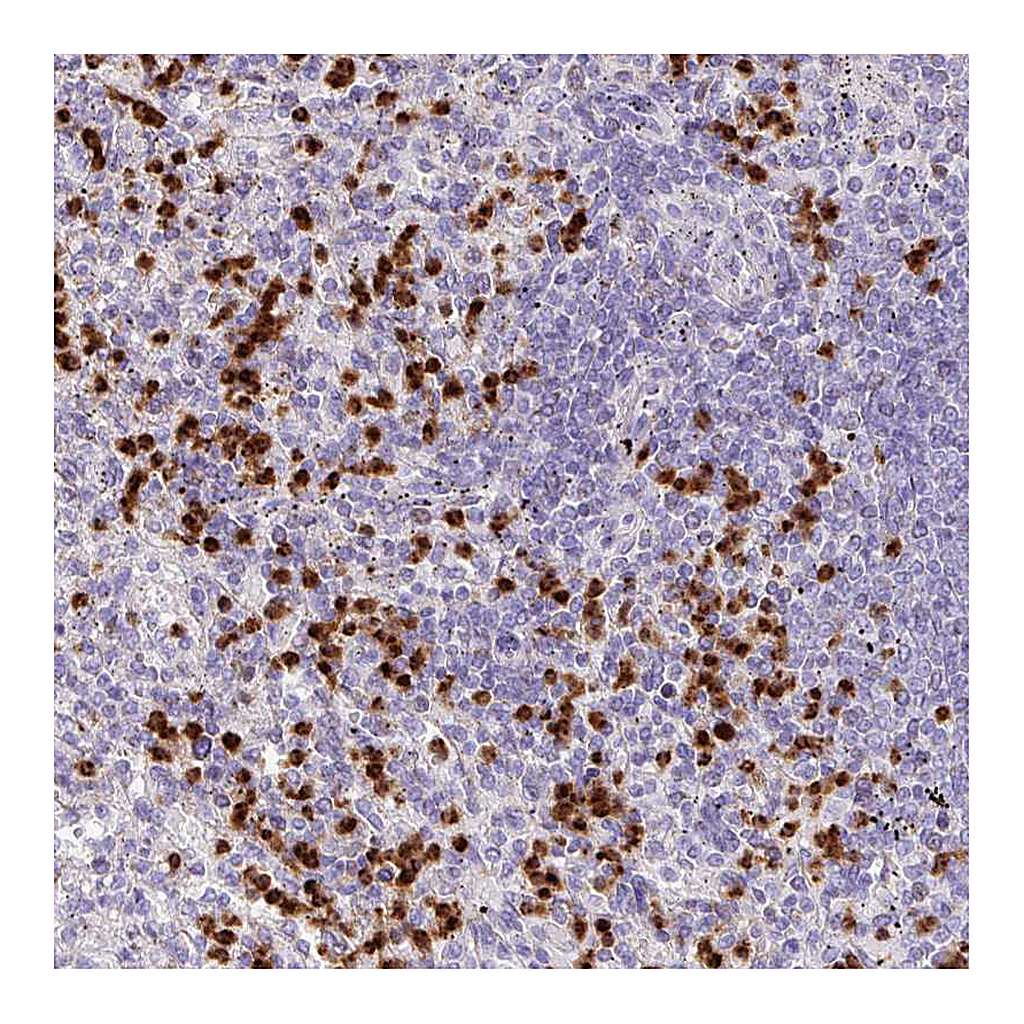 Atlas Antibodies Anti-RCAN2 Antibody