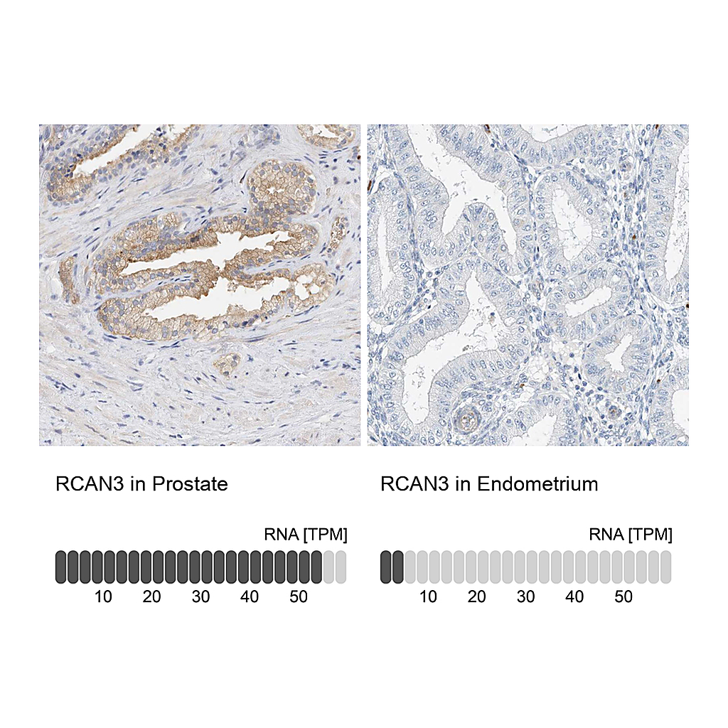 Atlas Antibodies Anti-RCAN3 Antibody