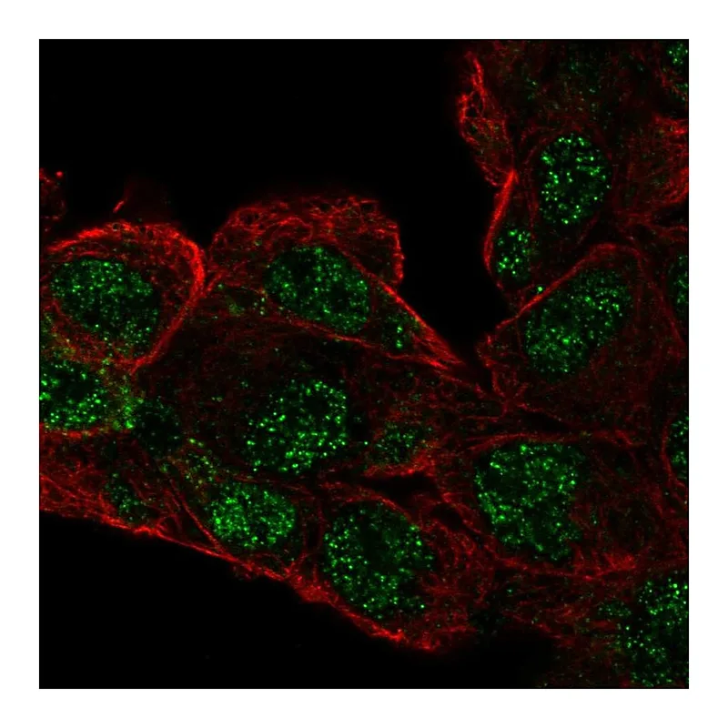 Atlas Antibodies Anti-RCBTB1 Antibody