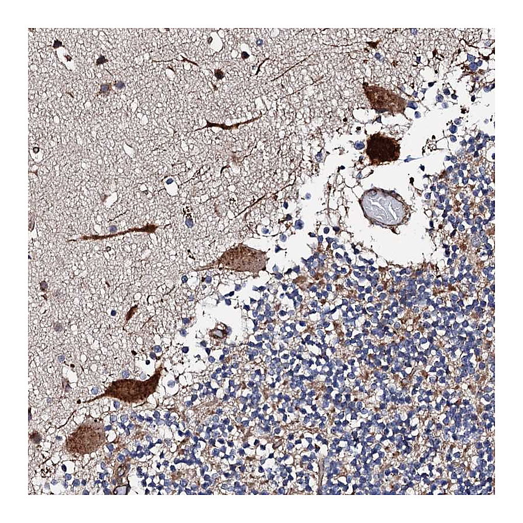 Atlas Antibodies Anti-RCBTB2 Antibody