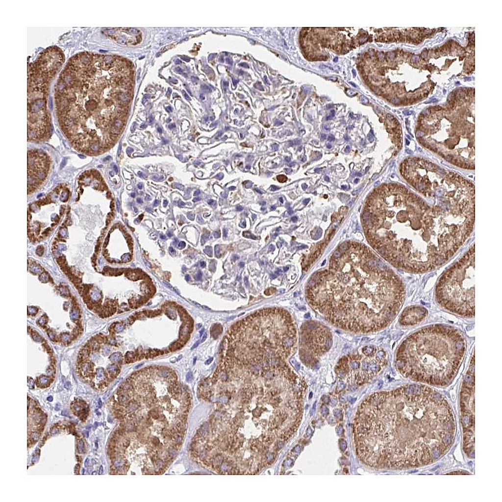 Atlas Antibodies Anti-RCC1L Antibody