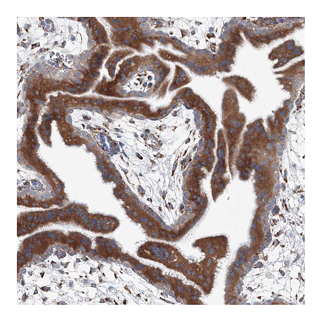 Atlas Antibodies Anti-RCN1 Antibody