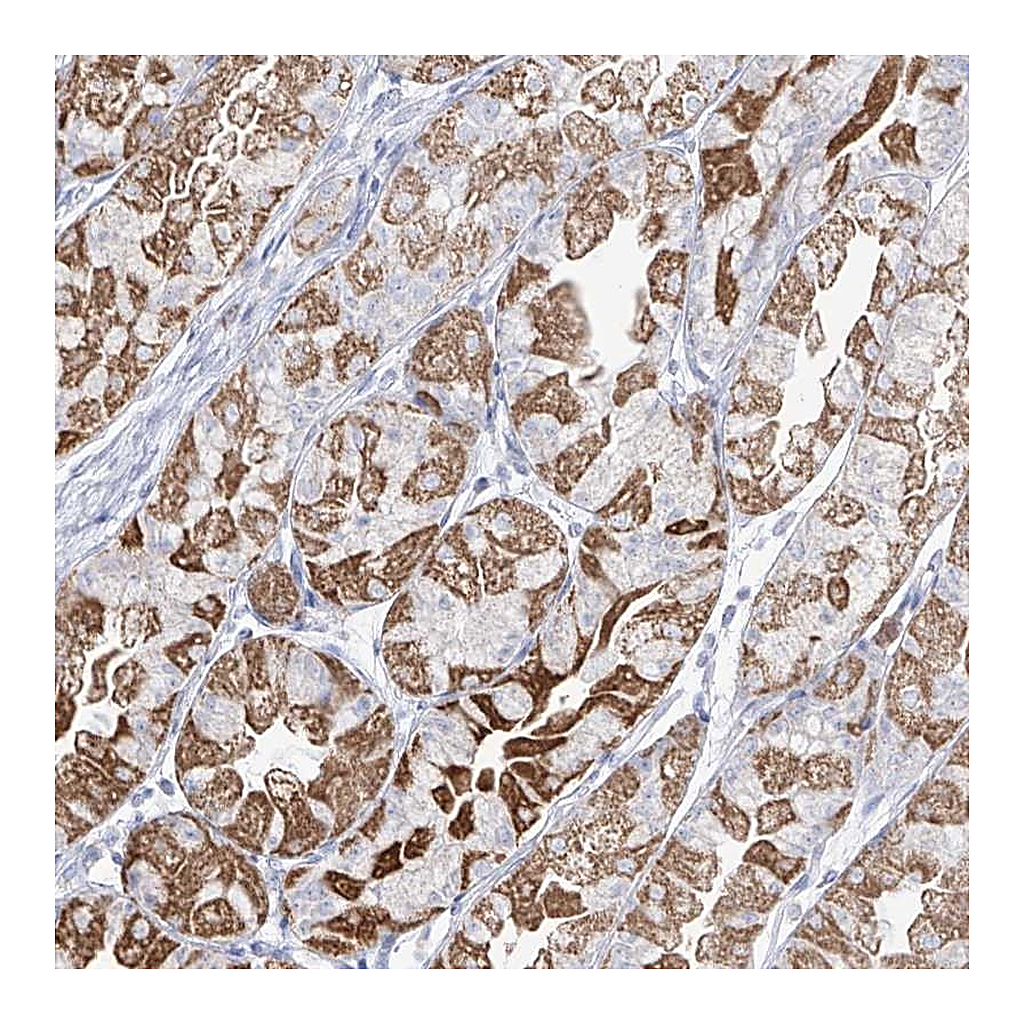 Atlas Antibodies Anti-RCHY1 Antibody