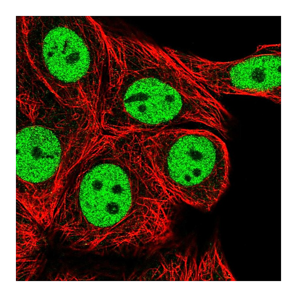 Atlas Antibodies Anti-RCOR1 Antibody
