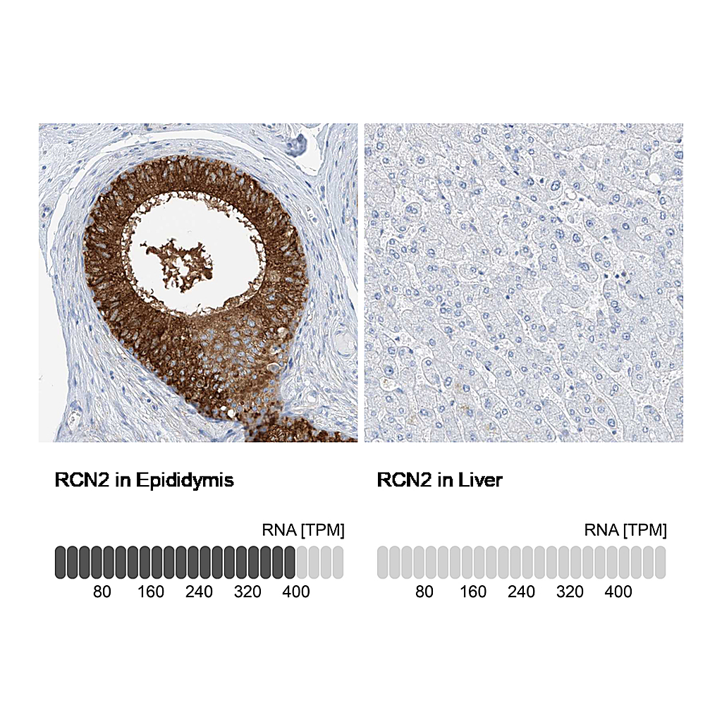 Atlas Antibodies Anti-RCN2 Antibody