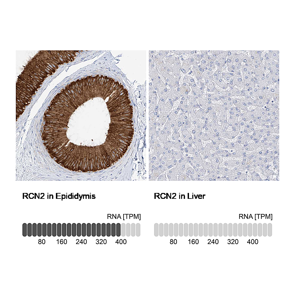 Atlas Antibodies Anti-RCN2 Antibody