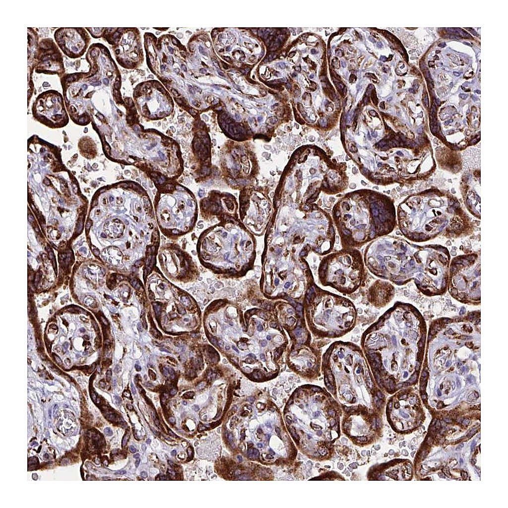 Atlas Antibodies Anti-RCN1 Antibody