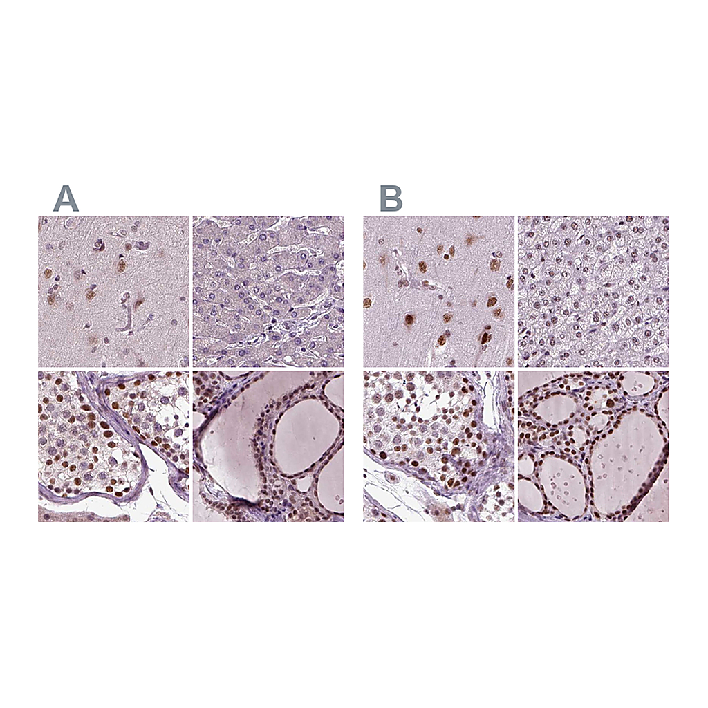 Atlas Antibodies Anti-RCOR3 Antibody