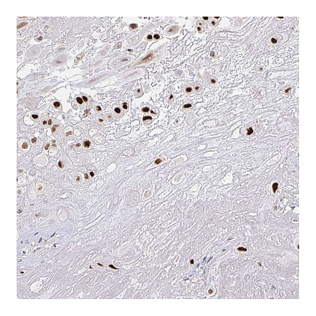 Atlas Antibodies Anti-RCOR1 Antibody
