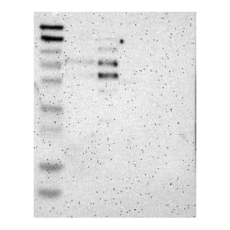 Atlas Antibodies Anti-RCOR3 Antibody