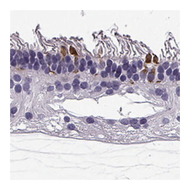 Atlas Antibodies Anti-RD3 Antibody