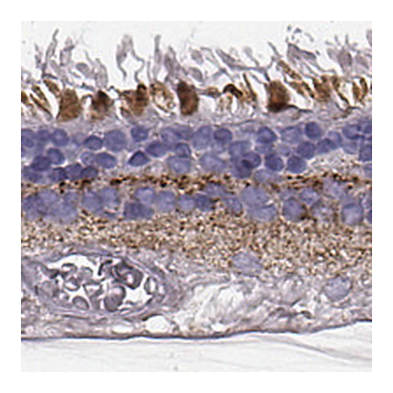 Atlas Antibodies Anti-RDH13 Antibody