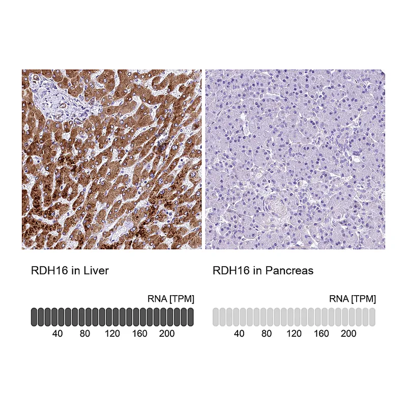 Atlas Antibodies Anti-RDH16 Antibody