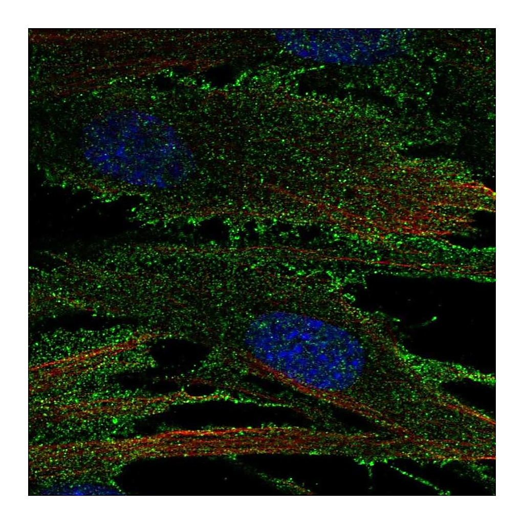 Atlas Antibodies Anti-RECK Antibody