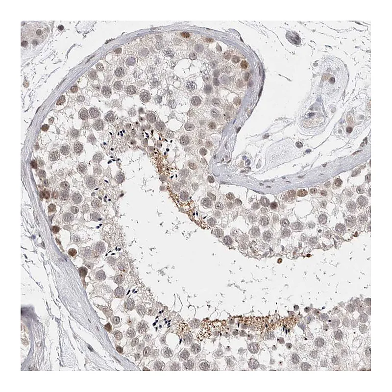 Atlas Antibodies Anti-RECQL4 Antibody