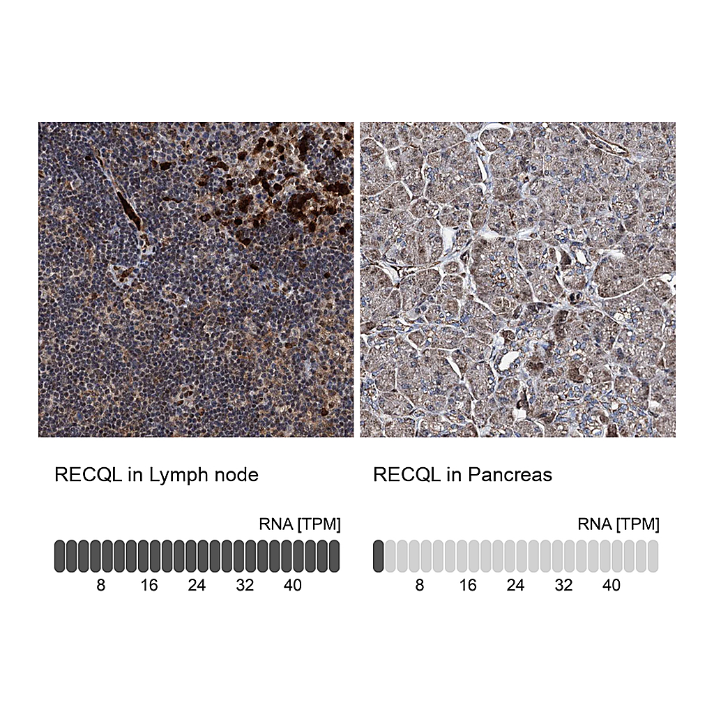 Atlas Antibodies Anti-RECQL Antibody