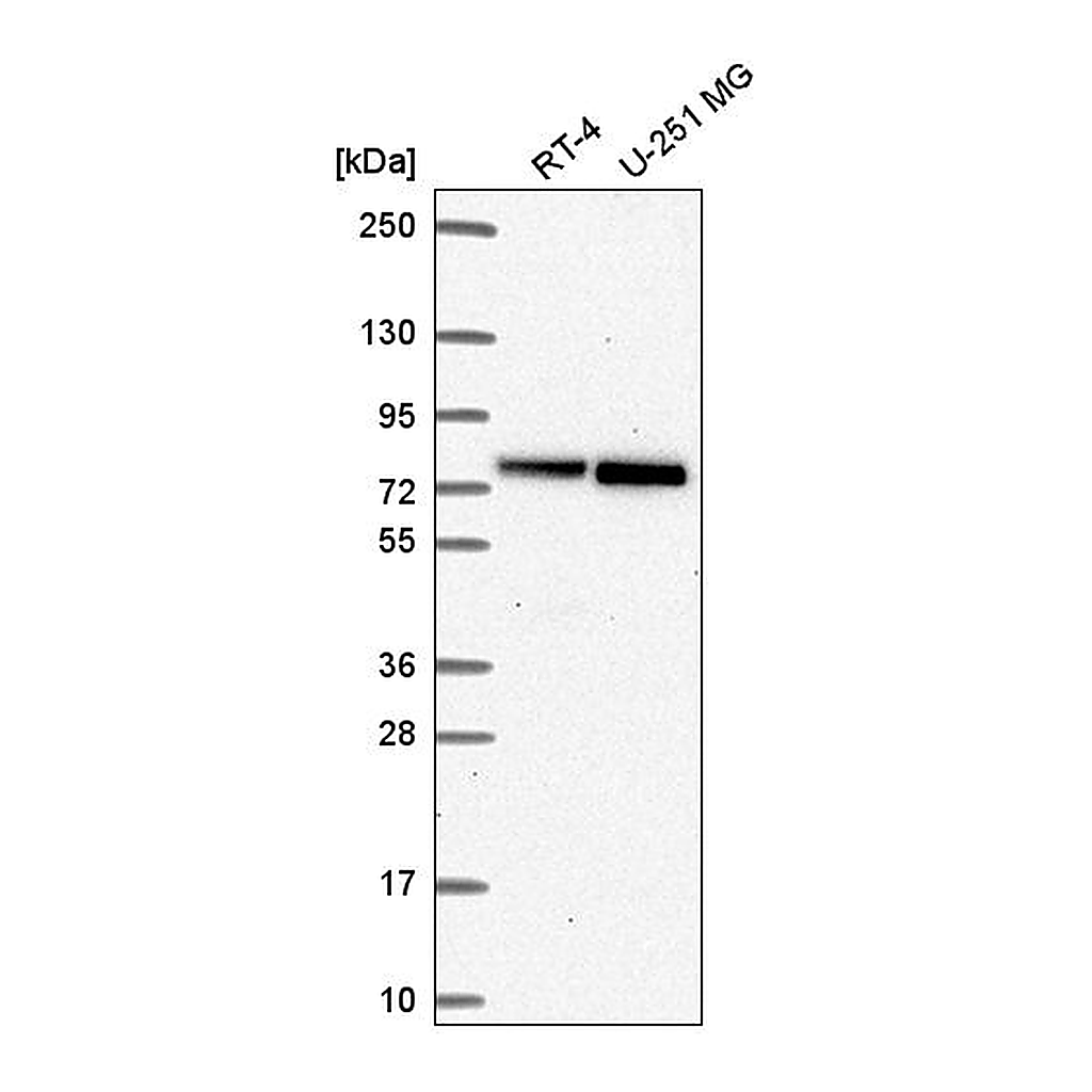 Atlas Antibodies Anti-RECQL Antibody